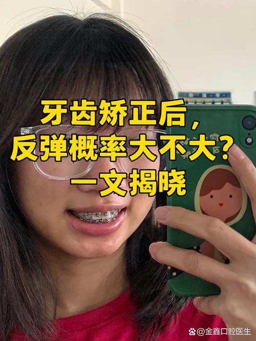 长沙成人牙齿反颌矫正 还来得及吗 真实经历告诉你答案