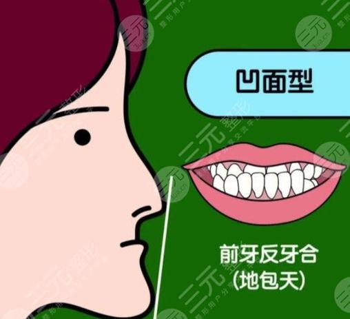 长沙深圳儿童地包天矫正多少钱？2026最新价格表来了