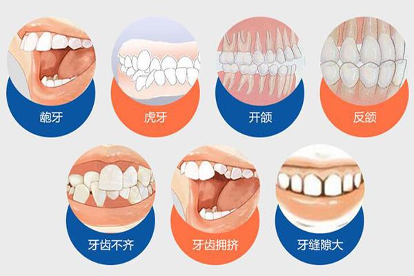 长沙合肥隐形牙齿矫正费用贵不贵?要多少钱?