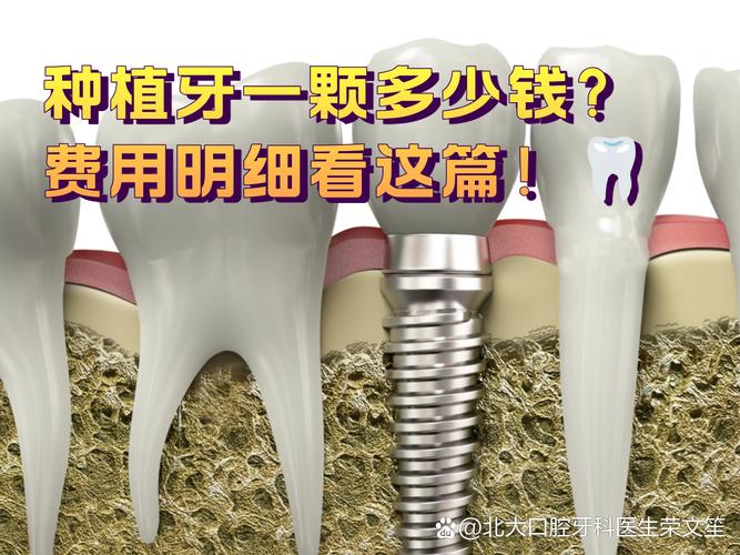 长沙2025年种牙一颗到底要花多少钱？看完这篇不踩坑