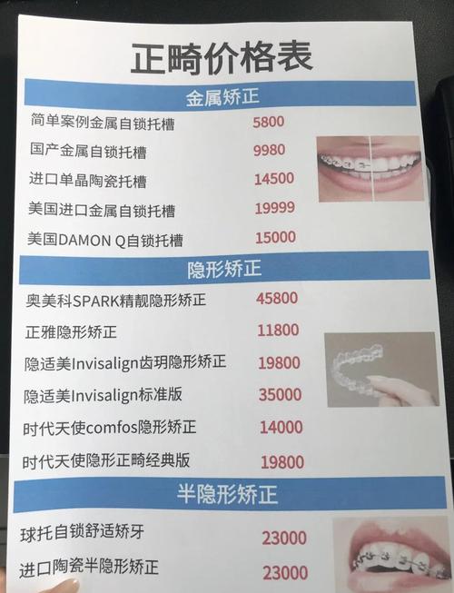 长沙成人矫正牙齿多少钱？2026年最新报价与避坑指南