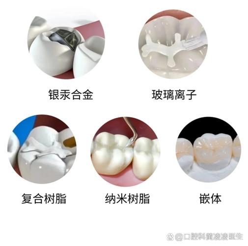长沙补牙用什么材料好？哪种补牙材料最靠谱？