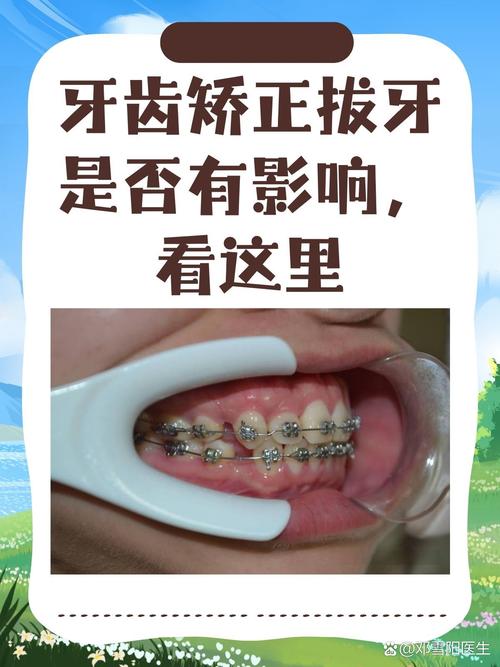 长沙哪个医院牙齿矫正比较好 教你避开这3个坑