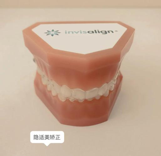 长沙深圳牙缝过大矫正多少钱 明细与避坑指南