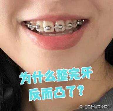 长沙牙齿不齐别担心 纠正牙齿的较佳年龄看这里