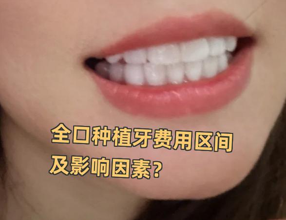 长沙深圳罗湖骨量不足全口种牙大概多少钱