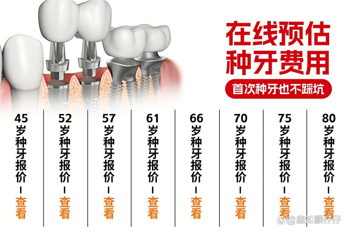 诺贝尔牙科种植牙价格_深圳诺贝尔种植牙门诊价格_诺贝尔种植牙售后服务电话