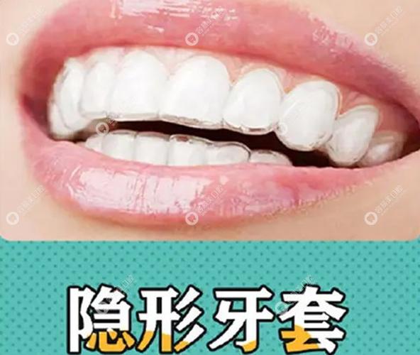 隐适美起诉时代天使膜片_隐适美和时代天使价格_深圳矫正隐适美和时代天使差价
