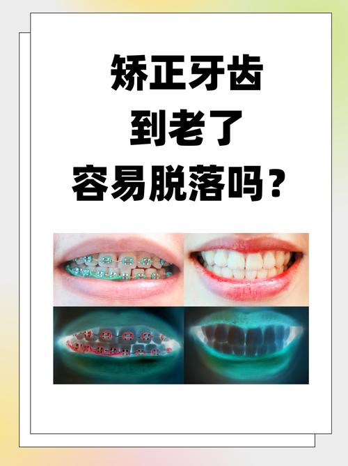 长沙43岁矫正牙齿晚不晚 过来人告诉你答案