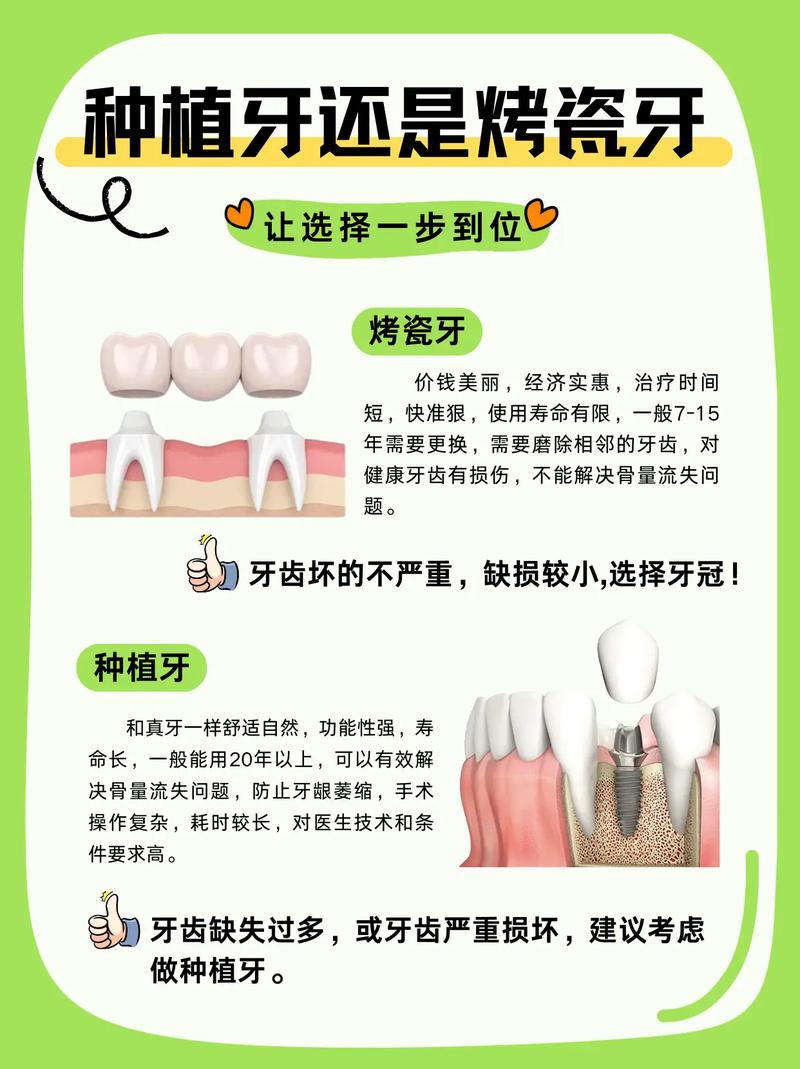长沙烤瓷牙还是种植牙 牙医教你选对修复方式