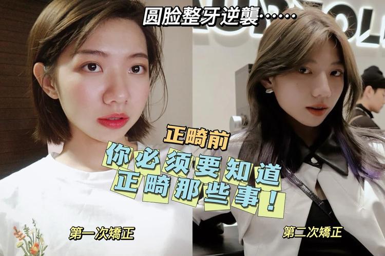 长沙23岁整牙还来得及吗?过来人说实话