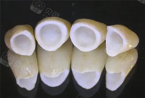 长沙深圳做全瓷牙到底要花多少钱？2026年最新报价揭秘