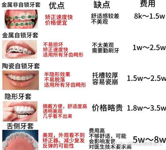 长沙深圳福田青少年做钢丝牙套大概要花多少钱？