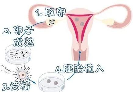 长沙第三代试管婴儿准备多少预算？这笔账你得算明白