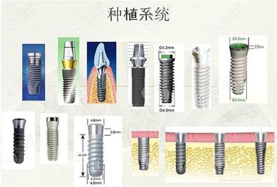 长沙种植牙国产韩系欧美价格对比，哪个品牌性价比高？