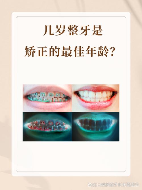 30岁以后能矫正牙齿吗_牙齿矫正后可以再矫正吗_以后牙齿矫正能用医保吗