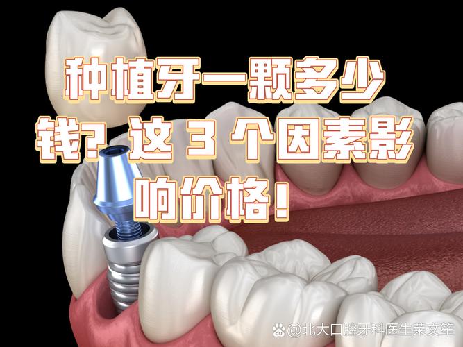 长沙镶一颗种牙要多少钱 影响种植牙费用的关键因素梳理