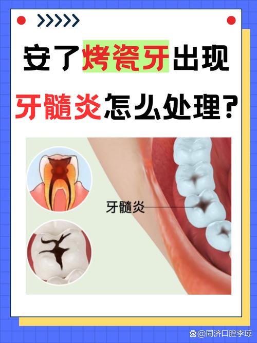 长沙牙医良心忠告：做烤瓷牙前这两点不注意，当心毁了整口牙