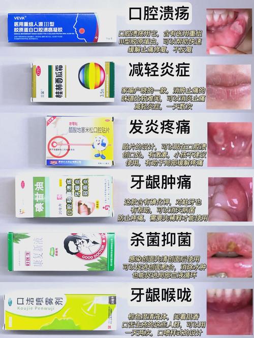 长沙小孩口腔溃疡吃什么好的快？收下这份家庭偏方与饮食指南，轻松缓解娃的疼痛