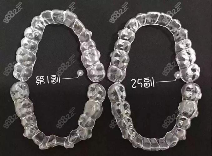 长沙深圳隐适美矫正费用全公开 花多少钱心里有数