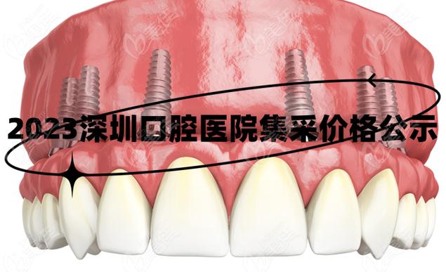 长沙深圳种牙集采落地，到底能省多少钱？