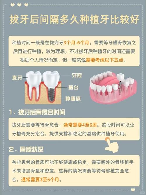 长沙拔牙后必须马上种牙吗？等多久最合适