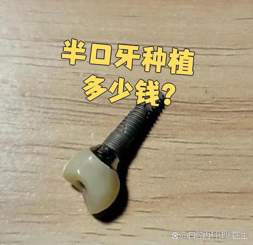 长沙深圳宝安半口种牙多少钱 中老年价格详解