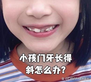 长沙深圳孩子换牙门牙歪斜怎么办？专业干预指南与避坑建议