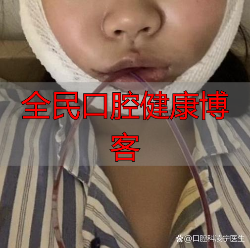 长沙口腔颌面部受伤啥特点？不只影响呼吸进食，感染风险也很高
