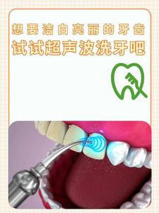 长沙自己用超声波洗牙安全吗？洗牙是医疗行为，别自己瞎搞