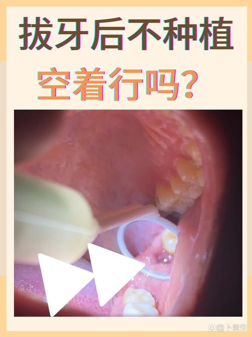 长沙成人拔牙后必须种牙吗？不种牙的后果，医生告诉你真相