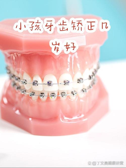 长沙16岁牙齿矫正晚吗？医生：抓住黄金期，效果一样好