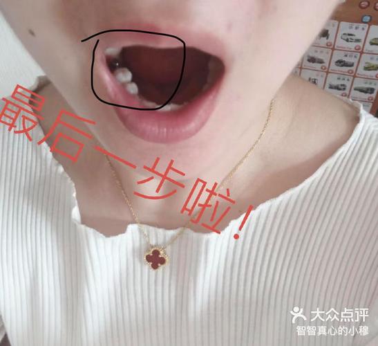 长沙宝安新安种植牙哪家医院好？真实体验告诉你