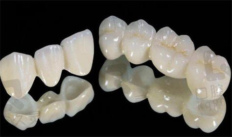 长沙深圳全瓷牙哪家牙科好 真实经验分享