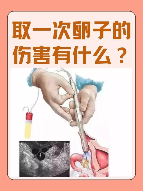 长沙取卵麻醉到底疼不疼 会不会影响卵子质量 医生一次说清