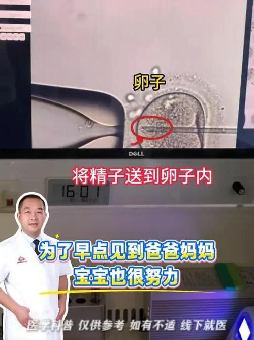 长沙二代试管原理详解 卵胞浆内单精子注射如何助孕