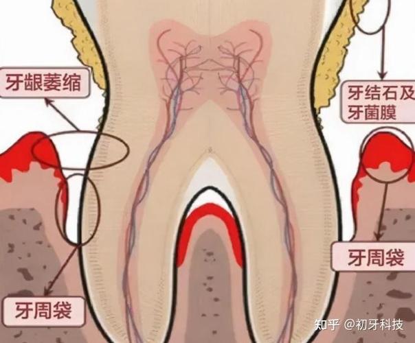 贵阳种植牙 2026 价格 单颗 3500-5500 元_贵阳种植牙齿_贵阳种植牙医院排名