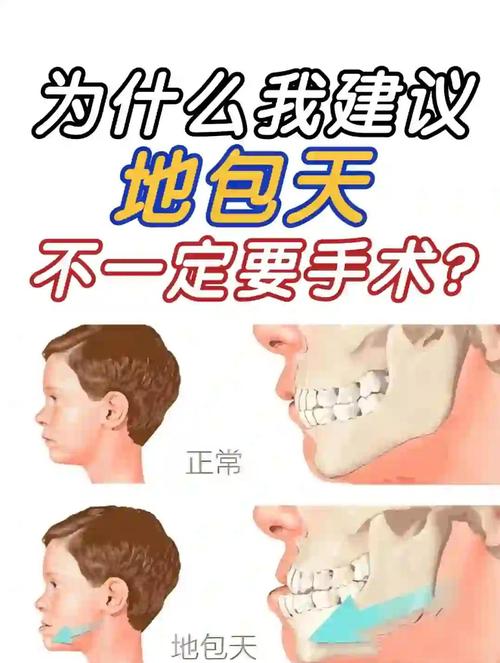 36岁牙齿地包天可以矫正吗_地包天用牙齿矫正器可以吗_牙齿地包天做正畸后会好看吗