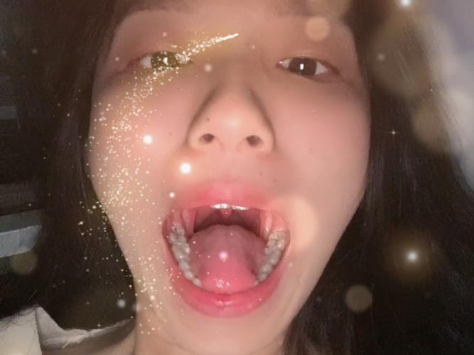 长沙口腔检查第一视角真的有用吗？
