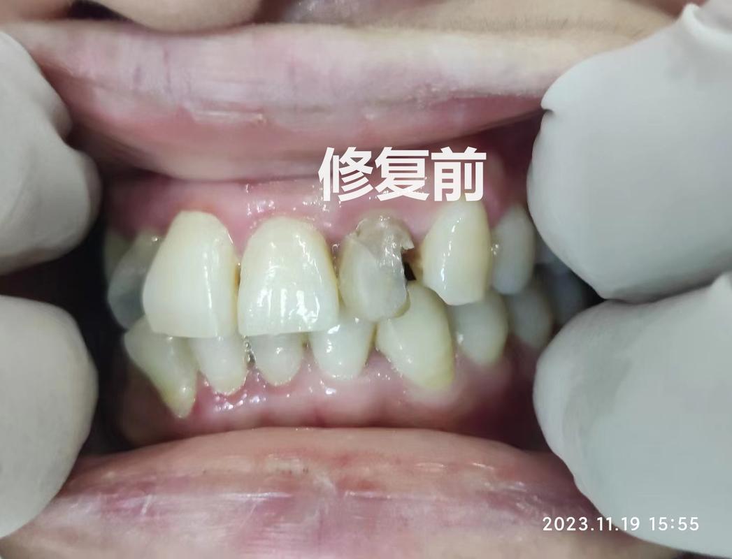 长沙口腔诊疗服务怎么挑不踩坑？看牙前你最好先把这几条搞明白