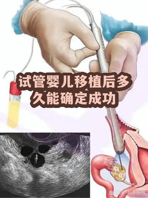 长沙一代试管婴儿能成功吗 看完心里有底