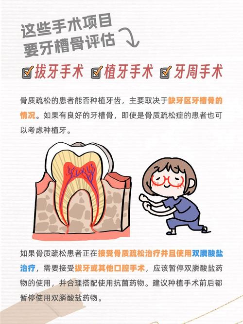 长沙骨质疏松能种牙吗 掌握这几点放心种