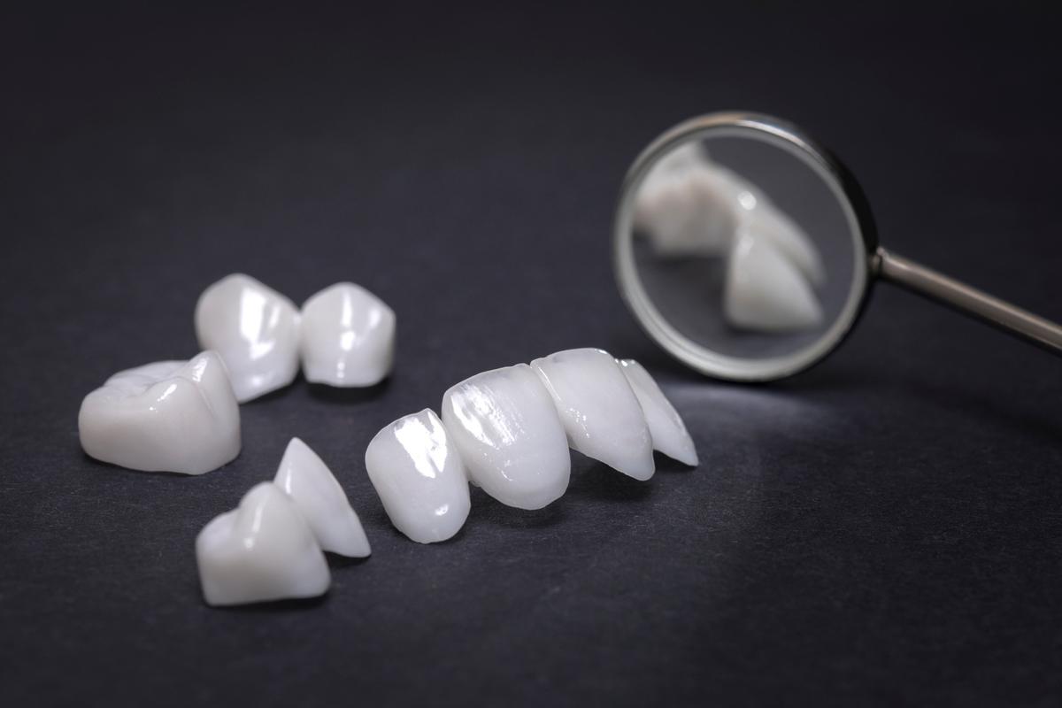 长沙牙齿矫正贴片价格揭秘：不同材质与方案费用详解