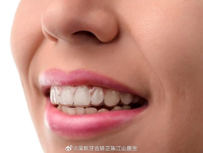 长沙成年人矫正牙齿多久能好？揭秘快速整牙的真相与代价