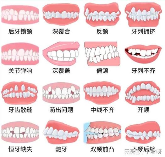长沙儿童牙齿矫正一般价格多少？带娃整牙到底花几万