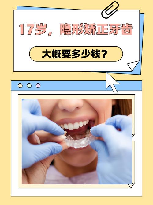 长沙德韩隐形矫正牙齿效果好吗 价格多少