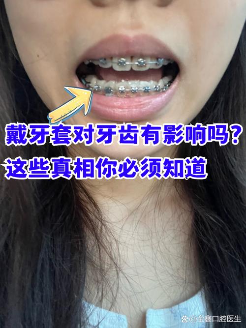 长沙成人矫正牙齿口腔值得做吗 这些真相医生不会主动说