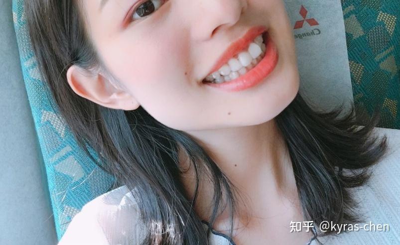长沙成人门牙不齐矫正真的很简单吗