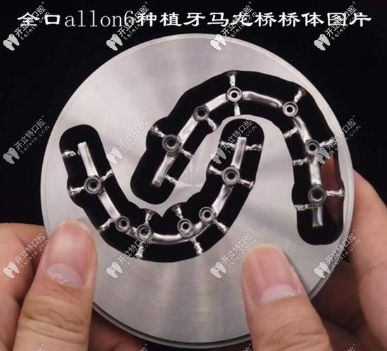 长沙深圳半口All-on-4种植牙医院怎么选？地址与避坑指南