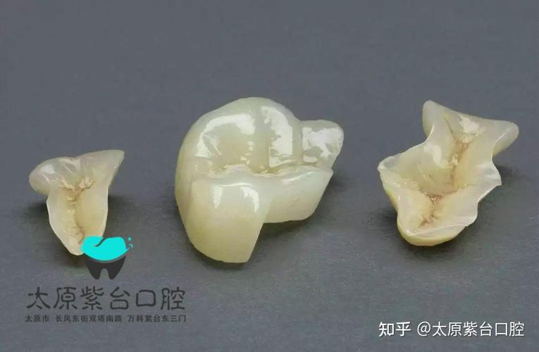 长沙口腔检查反馈单看不懂?3步教你秒读